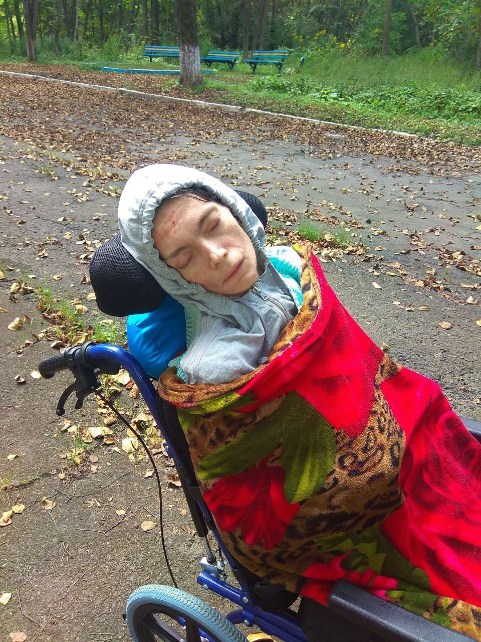 Vika, outside in the fresh air, in front of her rehabilitation facility. September 2018.