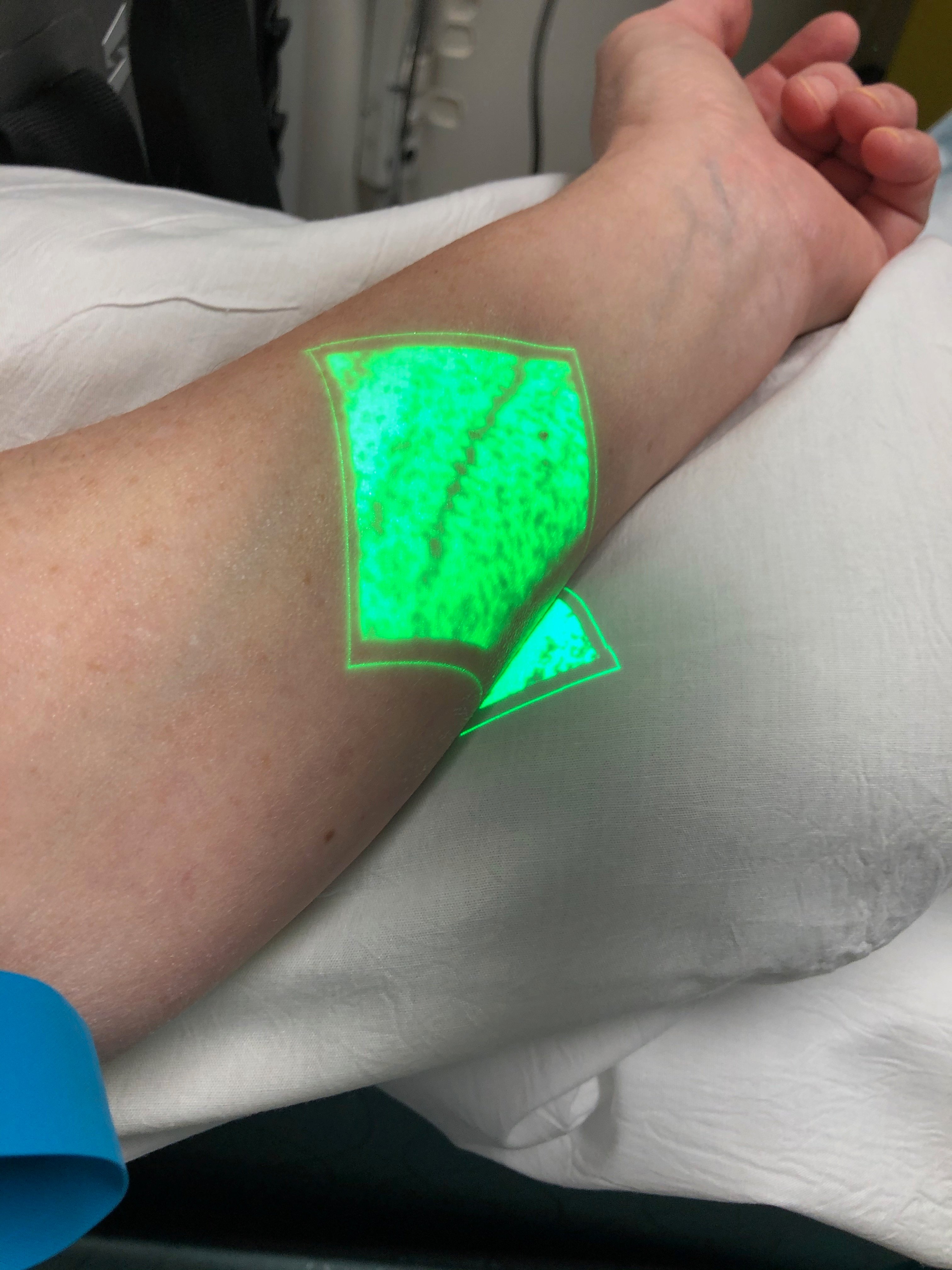 Incredible technology--the dark green line is my vein.