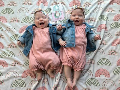 Eight&#x20;months&#x20;old&#x20;and&#x20;the&#x20;first&#x20;picture&#x20;of&#x20;the&#x20;two&#x20;of&#x20;them&#x20;without&#x20;feeding&#x20;tubes&#x20;on&#x20;their&#x20;faces&#x21;