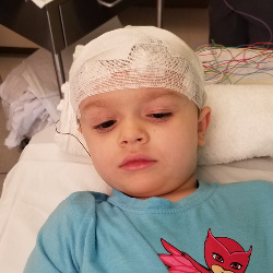 Having an EEG. He was getting tired and sleepy. 