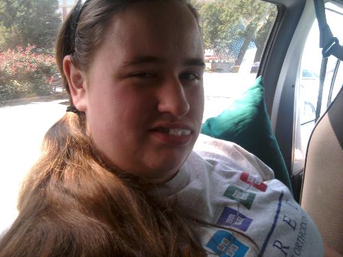 What I look like after oral surgery :P
