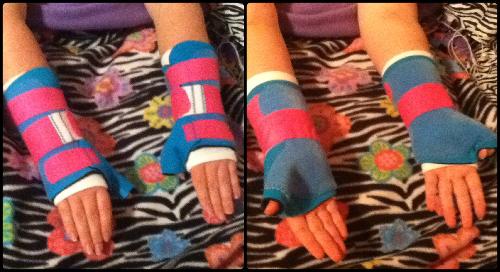 My new wrist braces. The white on the edge is a protective sock because of a mild allergy to them.