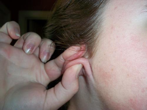 Fold your ears up with no pain.
