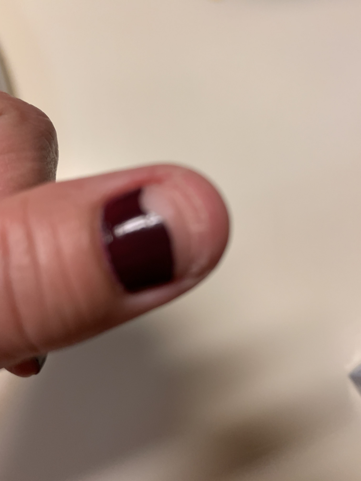 Broken nail from
Chemo.