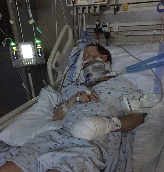 Dec 22, 2018 - In the ICU shortly after Sam's bike accident.