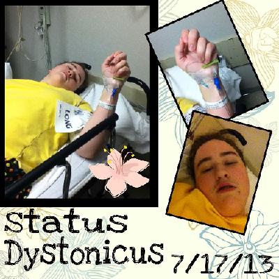After Status Dystonicus - July 17, 2013