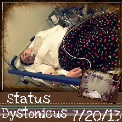 After Status Dystonicus - July 20, 2013
