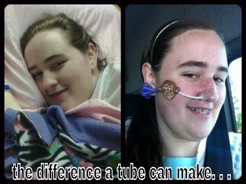 My tube has made SUCH a difference!