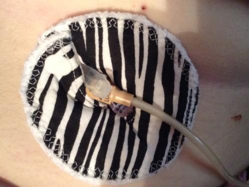 My first attempt at wearing a Gtube pad...didn't quite have it right! lol  {a picture of my Gtube with a zebra striped Gtube pad not quite on properly}