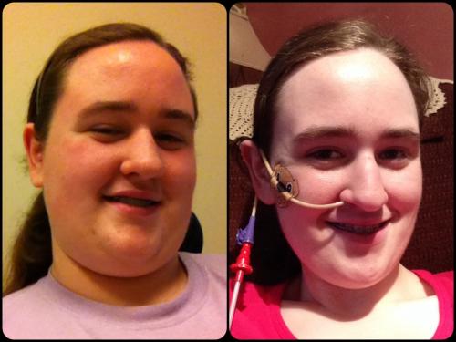 Just two selfies showing the difference after losing over 140 pounds...