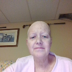 This damn Chemo...As I prepare for Treatment #4 on Monday....What Next! 
