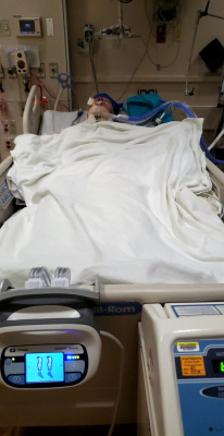 9/28/2018 - A picture Rick's brother Josh took of Rick in on the ventilator in the ICU. They had to cool his body down for 24 hours to prevent brain damage after his heart failure.