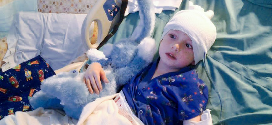 Gavin Pierson recuperates after surgery to stop "Joe Bully," the Intracranial Growing Teratoma Syndrome,growing in his brain.